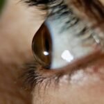 Ocular Cytokine Regulation: A New Frontier in Keratoconus Treatment